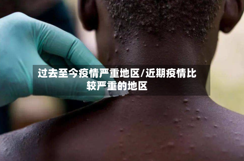 过去至今疫情严重地区/近期疫情比较严重的地区-第1张图片