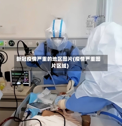 新冠疫情严重的地区图片(疫情严重图片区域)-第1张图片