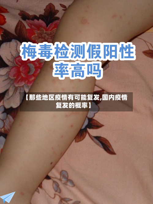 【那些地区疫情有可能复发,国内疫情复发的概率】-第1张图片